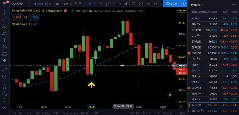 Thực hiện đặt lệnh dừng lỗ khi giao dịch Forex CFD là rất cần thiết
